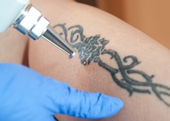 Wenn das Tattoo zur Last wird: Mit modernster Technik neue Haut zeigen